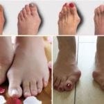 Cause di dolore alle gambe, trattamento, malattie che causano dolore alle gambe. Gambe ferite: cause, diagnosi, trattamento
