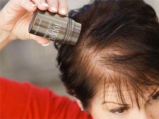 Calvizie negli uomini. Come prevenirlo e cosa fare in caso di calvizie? Perché gli uomini perdono i capelli in giovane età e come fermarli?