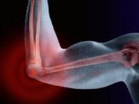 O que fazer se os músculos doerem após o treino. Dor após o exercício. Bom ou mal?
