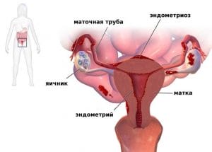 Dolor abdominal bajo en mujeres y hombres. Causas del dolor en la parte inferior del abdomen.