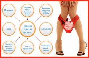 Dolor abdominal bajo en mujeres y hombres. Causas del dolor en la parte inferior del abdomen.