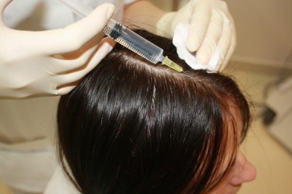 Caspa (seborrea). Descripción, tipos, prevención y tratamiento de la caspa. Caspa: síntomas, causas, tratamiento.
