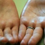 Why the palms of the hands in men sweat: the main causes and solutions to the problem. Sweating of the palms – causes and treatment