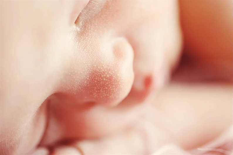 Die ersten Lebenstage eines Neugeborenen: Ratschläge eines Kinderarztes. Wie ein Neugeborenes aussehen sollte