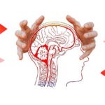 Hallucinations. Why and under what diseases do hallucinations appear?
